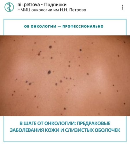 В шаге от онкологии: предраковые заболевания кожи и слизистых оболочек